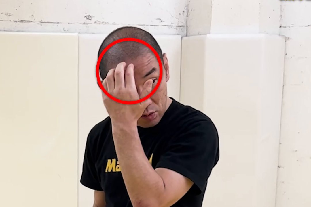 頭突きが来そうなら顎を引き、歯を合わせて額の硬い部分で受ける